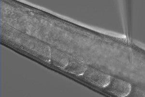 A needle inserted into genetic material