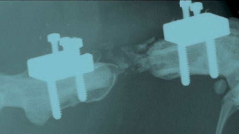 x ray of biomedical device