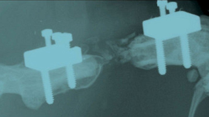 x ray of biomedical device