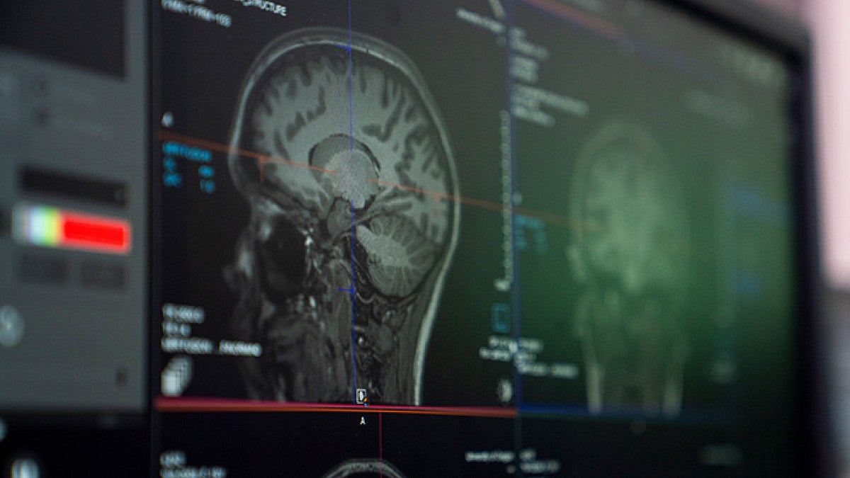 the results of an MRI on a computer screen